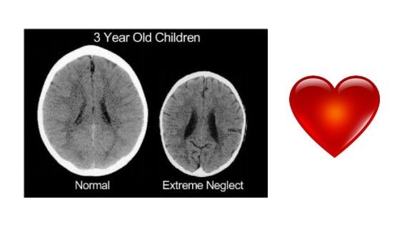 Sevgisiz ve ilgisiz  büyüyen çocuklar sorun oluyor